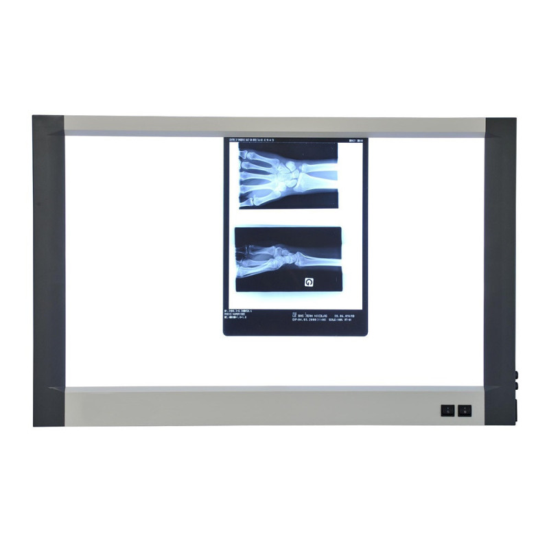 Négatoscope LED extra-plat 2 plages CE 100 x 64 cm Négatoscope LED extra-plat 2 plages CE 100 x 64 cm