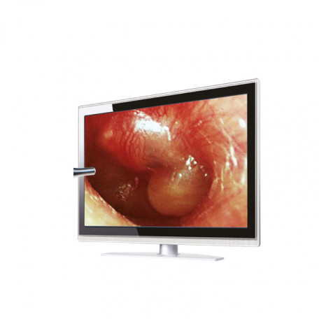 Otoscope VIDEO écran LCD 2.4
